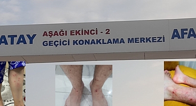 LAĞIM KOKUSUNDAN DURULMUYOR, SİVRİSİNEK HASTANELİK EDİYOR! ÇARE BULUN! DAYANILACAK GİBİ DEĞİL!