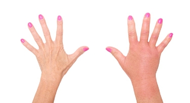 Ödem Atıcı Süper Besinler