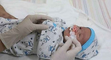 Merkez dudak ve damak yarığı olan çocuklara umut oldu
