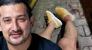 SERHAT AKIN’A SİLAHLI SALDIRI