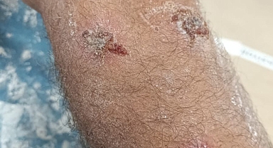 Kara: Gemiler Limana Angus Değil, Sağlık Sorunları Getiriyor