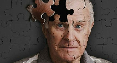 ALZHEİMER KAN TAHLİLİYLE ERKEN TEŞHİS EDİLEBİLECEK