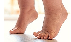 Çocuklarda Bu Yürüyüş Şekline Dikkat