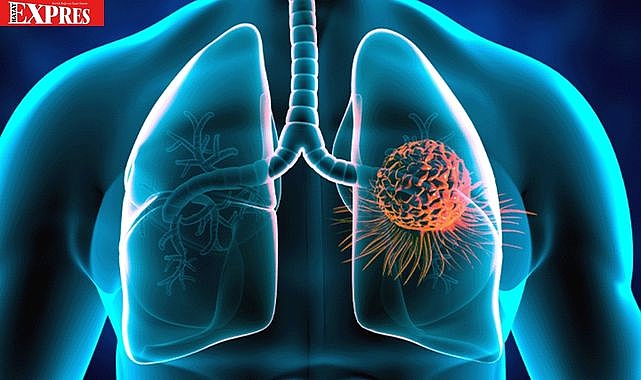 HATAY&#039;DA HER NEFES KANSER KANSER RİSKİ TAŞIYOR!