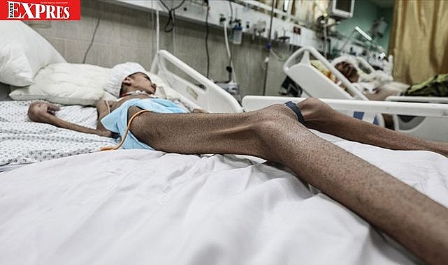 GAZZE'DE AÇLIK KRİZİ ARTARAK DEVAM EDİYOR!