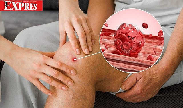 Modern Çağın Görünmez Katili: Tromboz Türkiye’de Can Alıyor