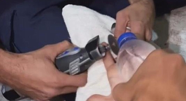 Vatandaşın İmdadına İtfaiye Ekipleri Yetişti