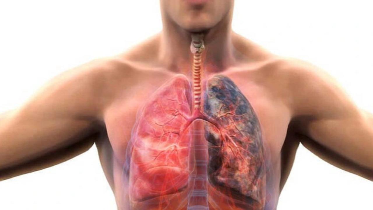 İKLİM DEĞİŞİKLİĞİ KOAH’I ARTIRIYOR