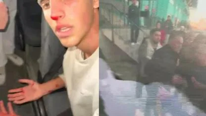 HATAY AMATÖR LİG  MAÇINDA KAN AKTI