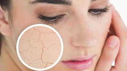 CİLT KURULUĞUNA  KARŞI 10 TAVSİYE