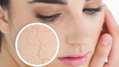 CİLT KURULUĞUNA  KARŞI 10 TAVSİYE